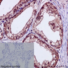 Immunohistochemistry (Formalin/PFA-fixed paraffin-embedded sections) - Anti-TBLR1/TBL1XR1+TBL1X+TBL1Y antibody [EPR16153] (AB190796), expandable thumbnail