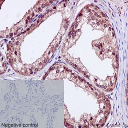 Immunohistochemistry (Formalin/PFA-fixed paraffin-embedded sections) - Anti-TBLR1/TBL1XR1+TBL1X+TBL1Y antibody [EPR16153] (AB190796)