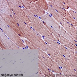 Immunohistochemistry (Formalin/PFA-fixed paraffin-embedded sections) - Anti-TBLR1/TBL1XR1+TBL1X+TBL1Y antibody [EPR16153] (AB190796), expandable thumbnail