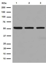 Western blot - Anti-TBLR1/TBL1XR1+TBL1X+TBL1Y antibody [EPR16153] (AB190796), expandable thumbnail
