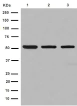 Western blot - Anti-TBLR1/TBL1XR1+TBL1X+TBL1Y antibody [EPR16153] (AB190796)