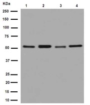 Western blot - Anti-TBLR1/TBL1XR1+TBL1X+TBL1Y antibody [EPR16153] (AB190796), expandable thumbnail