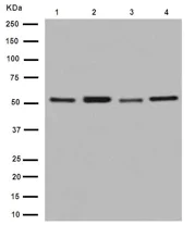 Western blot - Anti-TBLR1/TBL1XR1+TBL1X+TBL1Y antibody [EPR16153] (AB190796)