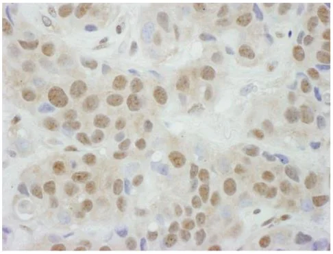 Immunohistochemistry (Formalin/PFA-fixed paraffin-embedded sections) - Anti-TBP-1 antibody (AB125164)