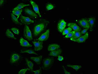 Immunocytochemistry/ Immunofluorescence - Anti-TBP-1 antibody (AB239029)