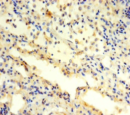 Immunohistochemistry (Formalin/PFA-fixed paraffin-embedded sections) - Anti-TBP-1 antibody (AB239029)