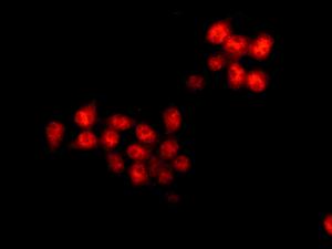 Immunocytochemistry/ Immunofluorescence - Anti-TBP-1 antibody [EPR12152] - BSA and Azide free (AB249681), expandable thumbnail