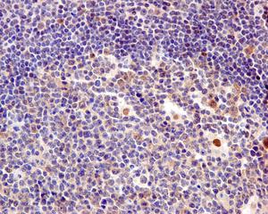 Immunohistochemistry (Formalin/PFA-fixed paraffin-embedded sections) - Anti-TBP-1 antibody [EPR12152] - BSA and Azide free (AB249681), expandable thumbnail