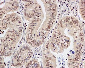 Immunohistochemistry (Formalin/PFA-fixed paraffin-embedded sections) - Anti-TBP-1 antibody [EPR12152] - BSA and Azide free (AB249681), expandable thumbnail
