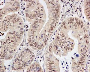 Immunohistochemistry (Formalin/PFA-fixed paraffin-embedded sections) - Anti-TBP-1 antibody [EPR12152] - BSA and Azide free (AB249681)