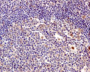 Immunohistochemistry (Formalin/PFA-fixed paraffin-embedded sections) - Anti-TBP-1 antibody [EPR12152] - N-terminal (AB171969)