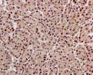 Immunohistochemistry (Formalin/PFA-fixed paraffin-embedded sections) - Anti-TBP-1 antibody [EPR12153] (AB171974)