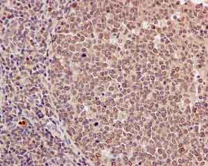 Immunohistochemistry (Formalin/PFA-fixed paraffin-embedded sections) - Anti-TBP-1 antibody [EPR12153] - BSA and Azide free (AB249686)