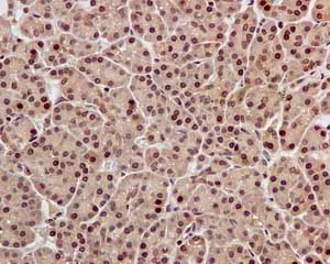 Immunohistochemistry (Formalin/PFA-fixed paraffin-embedded sections) - Anti-TBP-1 antibody [EPR12153] - BSA and Azide free (AB249686)