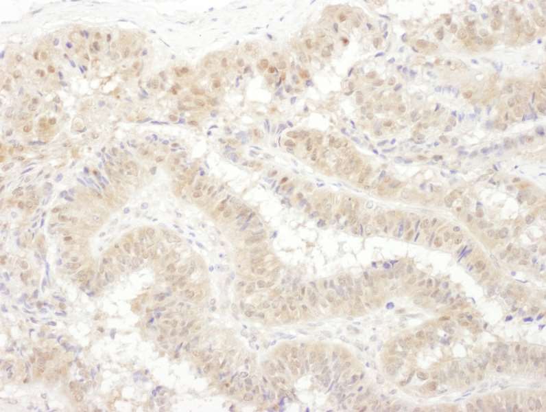 Immunohistochemistry (Formalin/PFA-fixed paraffin-embedded sections) - Anti-Tbp7 antibody (AB140515), expandable thumbnail