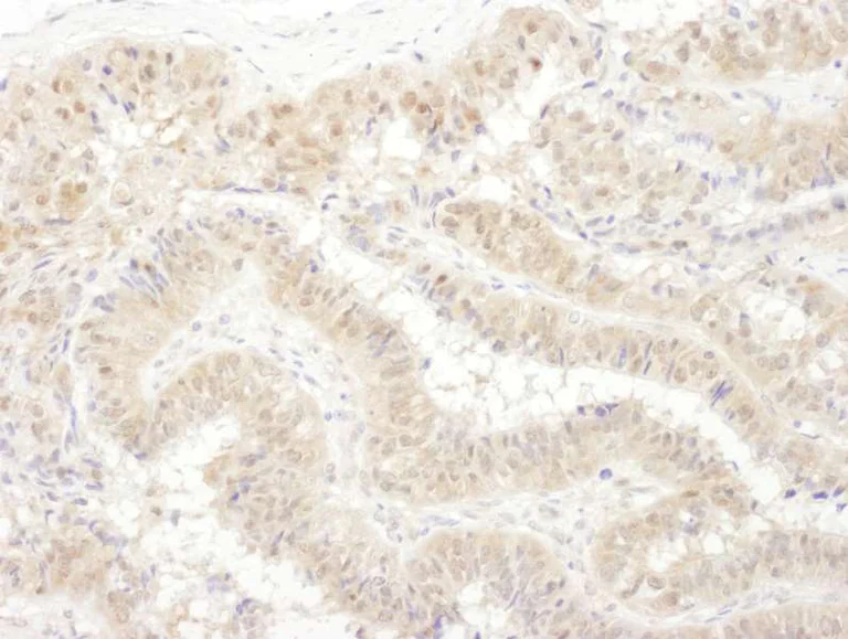 Immunohistochemistry (Formalin/PFA-fixed paraffin-embedded sections) - Anti-Tbp7 antibody (AB140515)