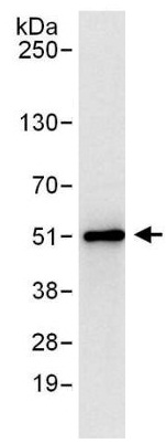 Immunoprecipitation - Anti-Tbp7 antibody (AB140515), expandable thumbnail