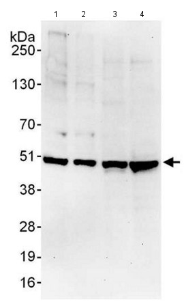 Western blot - Anti-Tbp7 antibody (AB140515), expandable thumbnail