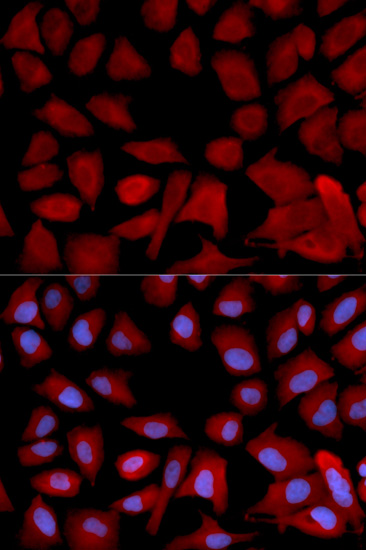 Immunocytochemistry/ Immunofluorescence - Anti-Tbp7 antibody (AB196589), expandable thumbnail