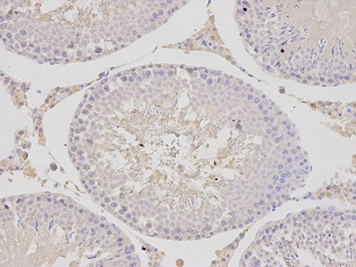 Immunohistochemistry (Formalin/PFA-fixed paraffin-embedded sections) - Anti-Tbp7 antibody (AB196589), expandable thumbnail