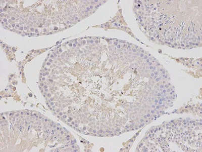 Immunohistochemistry (Formalin/PFA-fixed paraffin-embedded sections) - Anti-Tbp7 antibody (AB196589)
