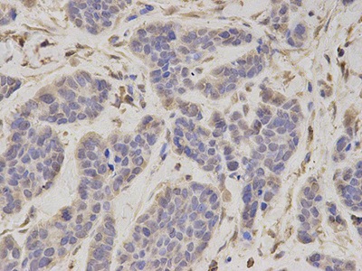 Immunohistochemistry (Formalin/PFA-fixed paraffin-embedded sections) - Anti-Tbp7 antibody (AB196589), expandable thumbnail