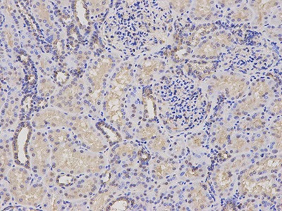 Immunohistochemistry (Formalin/PFA-fixed paraffin-embedded sections) - Anti-Tbp7 antibody (AB196589), expandable thumbnail