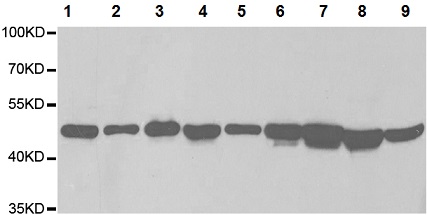Western blot - Anti-Tbp7 antibody (AB196589), expandable thumbnail