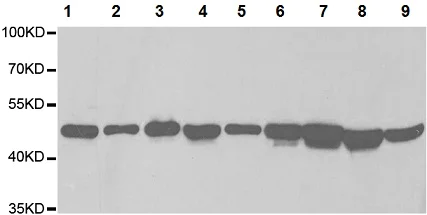 Western blot - Anti-Tbp7 antibody (AB196589)