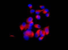 Immunocytochemistry/ Immunofluorescence - Anti-Tbp7 antibody [EPR9911(B)] (AB139184)