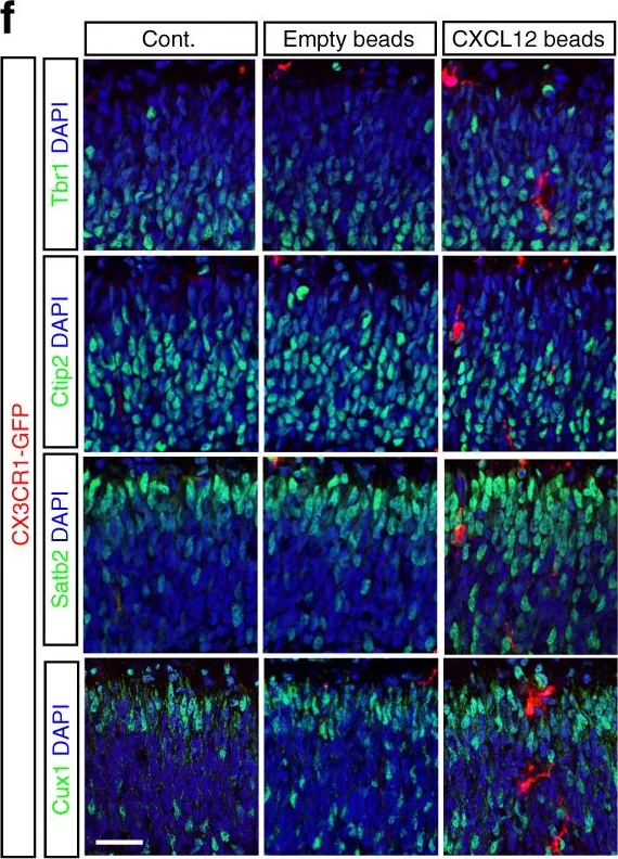 Immunohistochemistry - Anti-TBR1 antibody (AB31940)