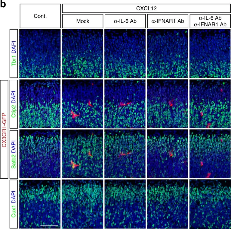 Immunohistochemistry - Anti-TBR1 antibody (AB31940)