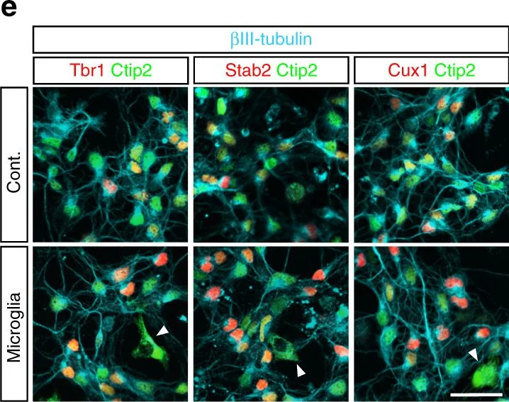 Immunohistochemistry - Anti-TBR1 antibody (AB31940)