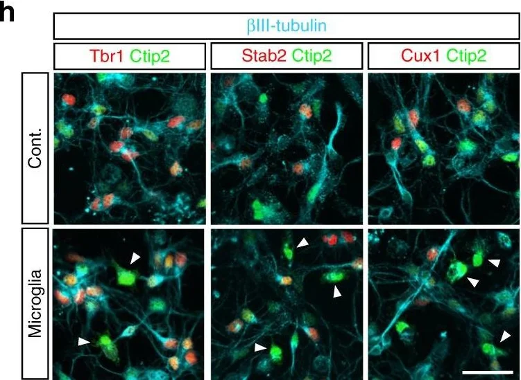 Immunohistochemistry - Anti-TBR1 antibody (AB31940)
