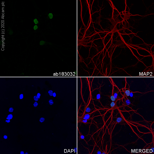 Immunocytochemistry/ Immunofluorescence - Anti-TBR1 antibody [EPR8138(2)] - BSA and Azide free (AB239000), expandable thumbnail