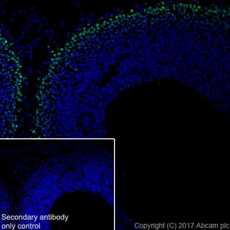 Immunohistochemistry (Frozen sections) - Anti-TBR1 antibody [EPR8138(2)] - BSA and Azide free (AB239000), expandable thumbnail