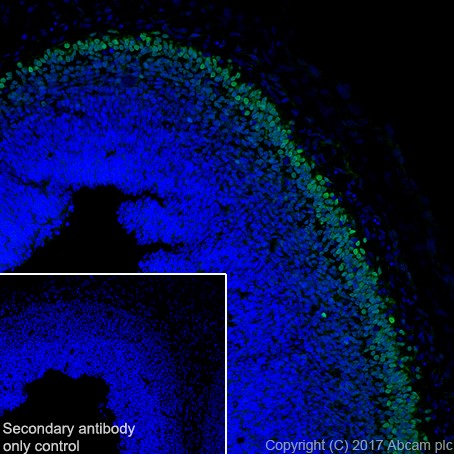 Immunohistochemistry (Frozen sections) - Anti-TBR1 antibody [EPR8138(2)] - BSA and Azide free (AB239000), expandable thumbnail