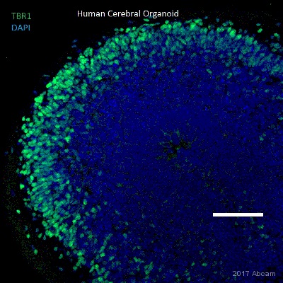 Immunohistochemistry (Frozen sections) - Anti-TBR1 antibody [EPR8138(2)] - BSA and Azide free (ab239000), expandable thumbnail