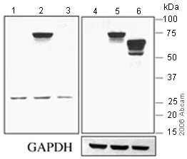 Western blot - Anti-TBR2 / Eomes antibody (AB23345)
