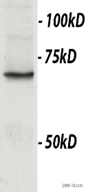 Western blot - Anti-TBR2 / Eomes antibody (AB23345)