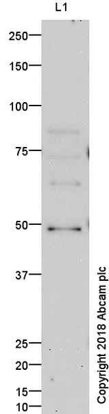 Western blot - Anti-TBR2 / Eomes antibody (AB23345)