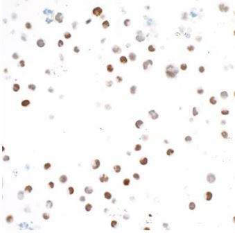 Immunocytochemistry - Anti-TBR2 / Eomes antibody [BLR104H] - BSA free (AB275960), expandable thumbnail