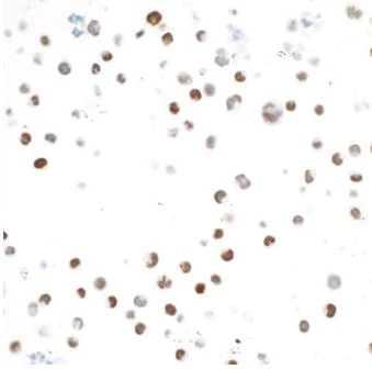 Immunocytochemistry - Anti-TBR2 / Eomes antibody [BLR104H] - BSA free (AB275960)