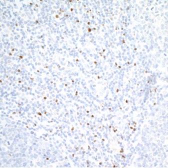 Immunohistochemistry (Formalin/PFA-fixed paraffin-embedded sections) - Anti-TBR2 / Eomes antibody [BLR104H] - BSA free (AB275960), expandable thumbnail