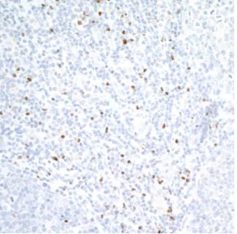 Immunohistochemistry (Formalin/PFA-fixed paraffin-embedded sections) - Anti-TBR2 / Eomes antibody [BLR104H] - BSA free (AB275960)