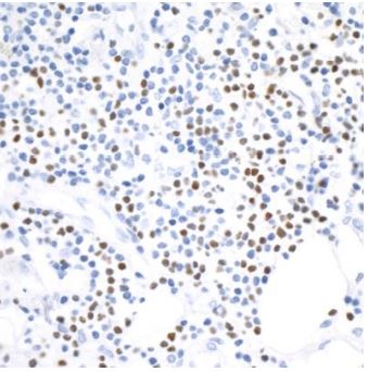 Immunohistochemistry (Formalin/PFA-fixed paraffin-embedded sections) - Anti-TBR2 / Eomes antibody [BLR104H] - BSA free (AB275960), expandable thumbnail