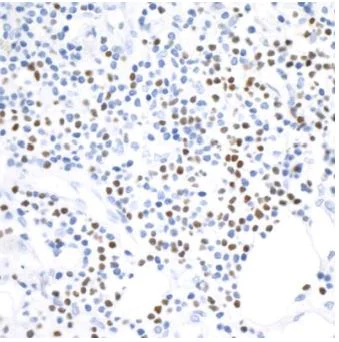 Immunohistochemistry (Formalin/PFA-fixed paraffin-embedded sections) - Anti-TBR2 / Eomes antibody [BLR104H] - BSA free (AB275960)