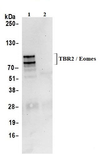 Immunoprecipitation - Anti-TBR2 / Eomes antibody [BLR104H] - BSA free (AB275960), expandable thumbnail