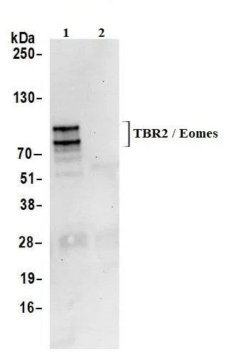 Immunoprecipitation - Anti-TBR2 / Eomes antibody [BLR104H] - BSA free (AB275960)