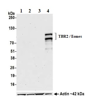 Western blot - Anti-TBR2 / Eomes antibody [BLR104H] - BSA free (AB275960), expandable thumbnail